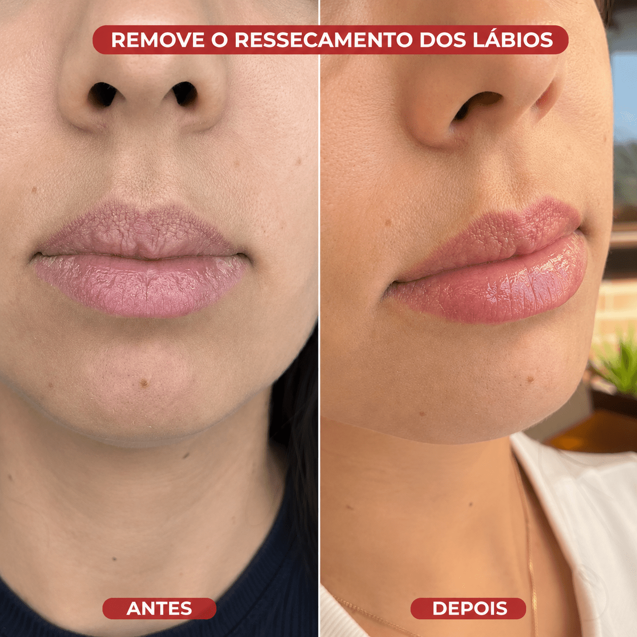 Lip Sleeping Mask® - usCare