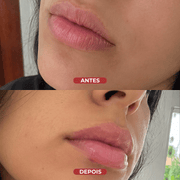 Lip Sleeping Mask® - usCare