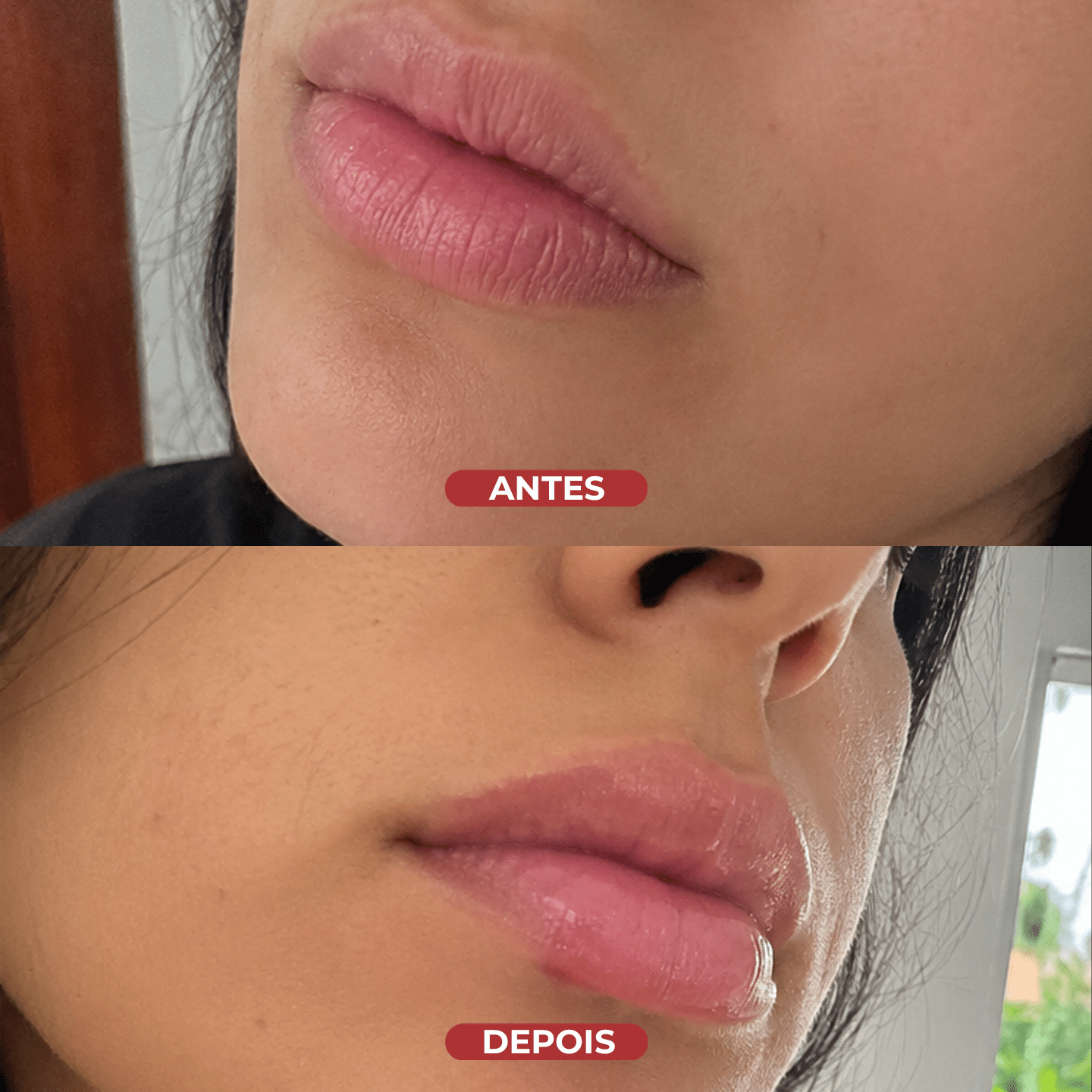 Lip Sleeping Mask® - usCare