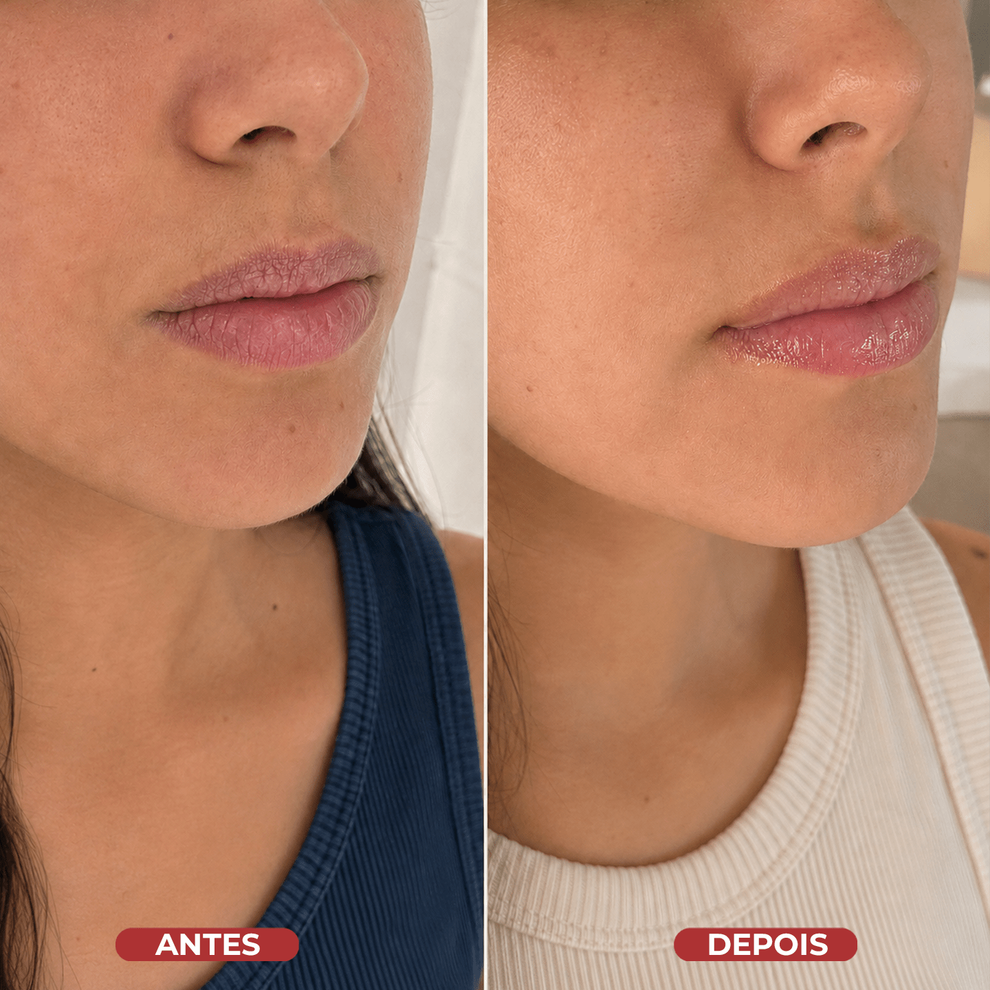Lip Sleeping Mask® - usCare