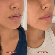 Lip Sleeping Mask® - usCare