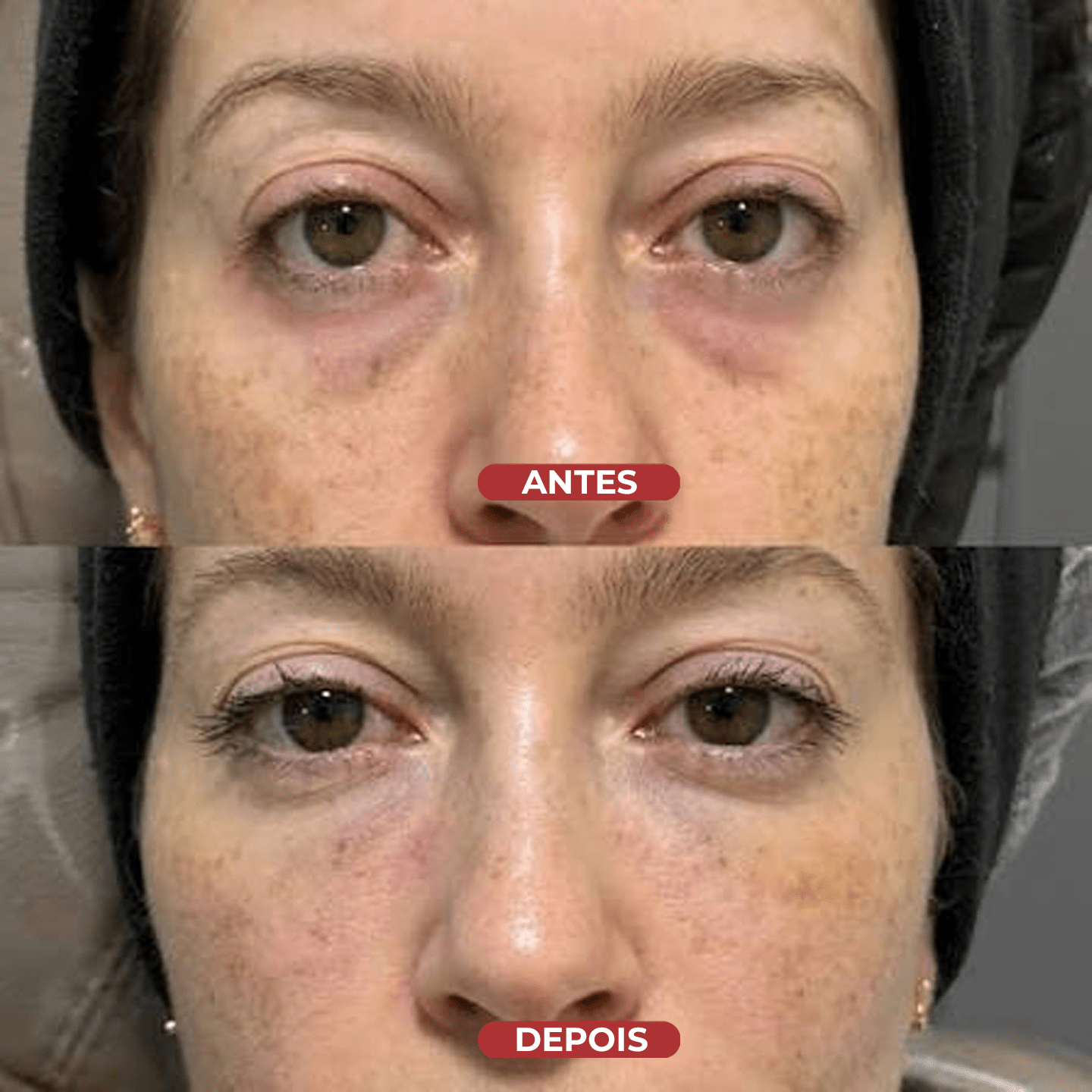 Revive Eye Sérum - Centella® - usCare