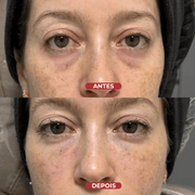 Revive Eye Sérum - Centella® - usCare