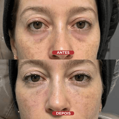 Revive Eye Sérum - Centella® - usCare