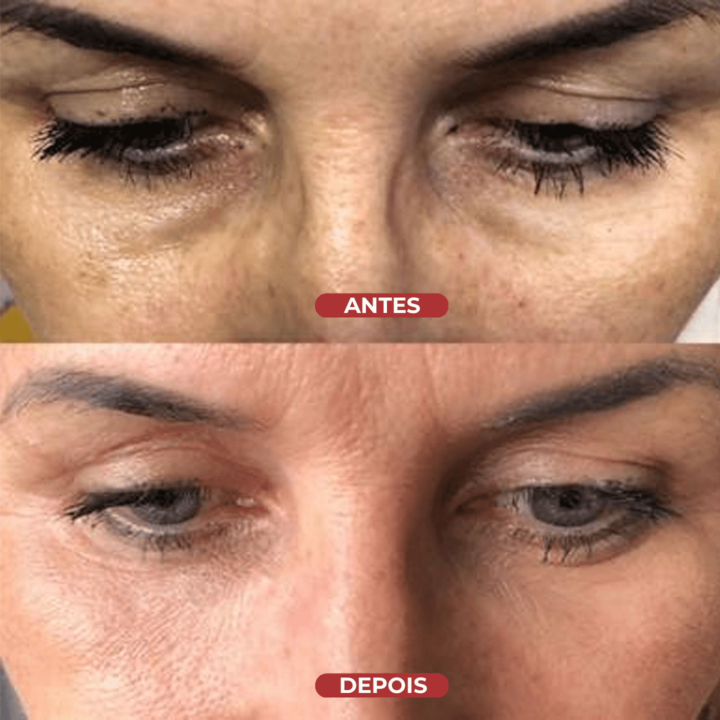 Revive Eye Sérum - Centella® - usCare