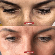 Revive Eye Sérum - Centella® - usCare